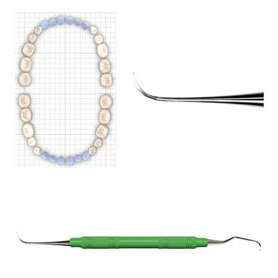 AMERICAN EAGLE Implant Instrument Nebraska 128/Langer 5 Scaler DE Green Resin Handle 3/8 in